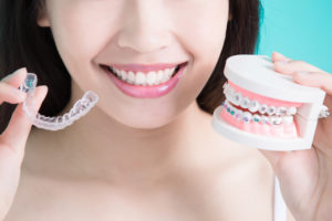 Invisalign